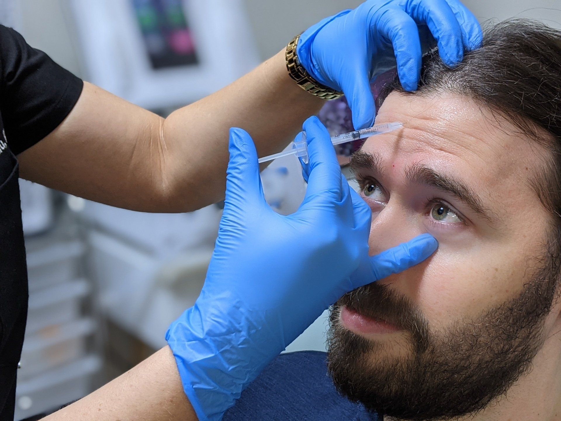 Botox injection treatment for forehead lines at Skin & Soul Med Spa