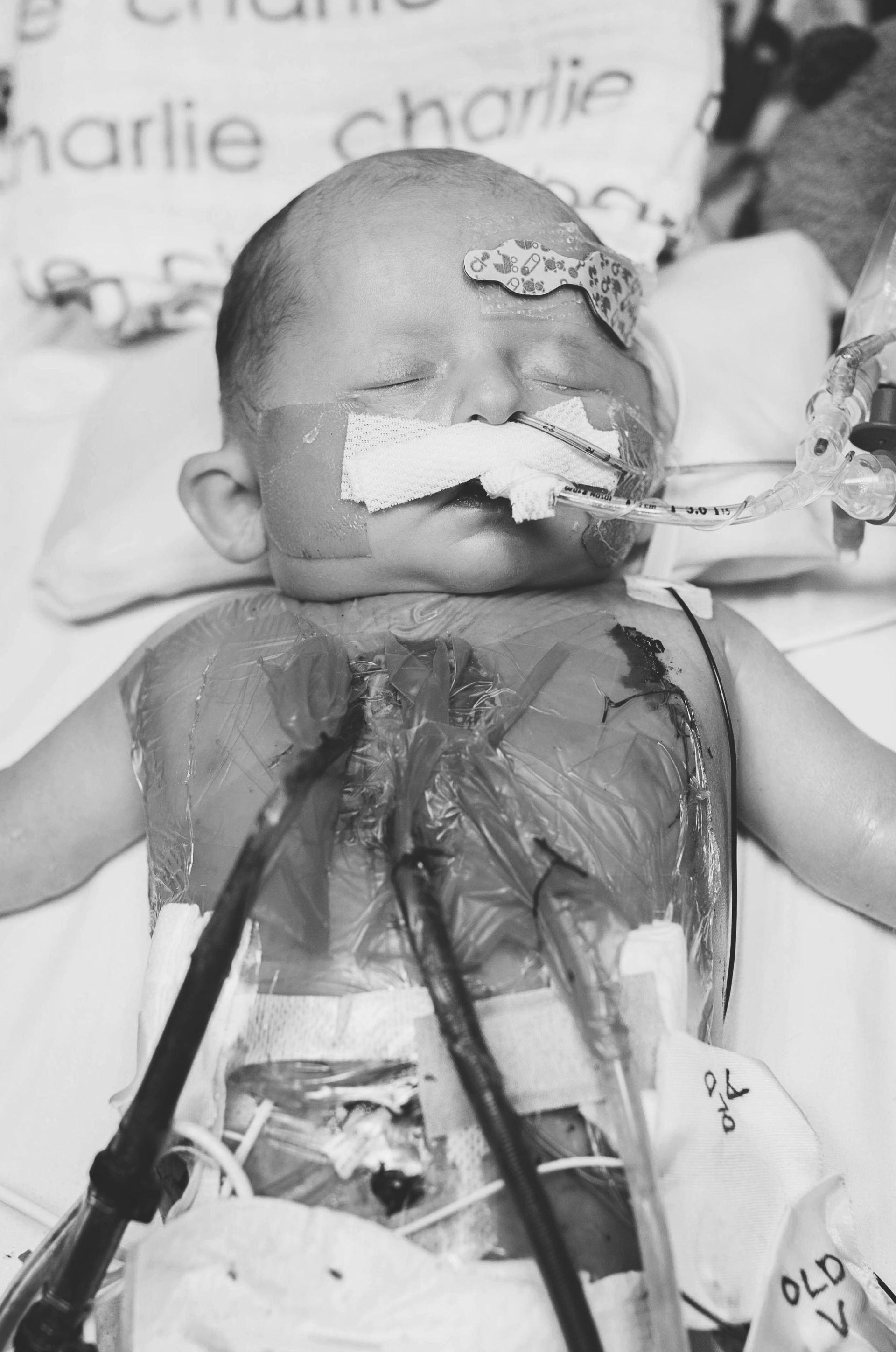 world of broken hearts heart defects
