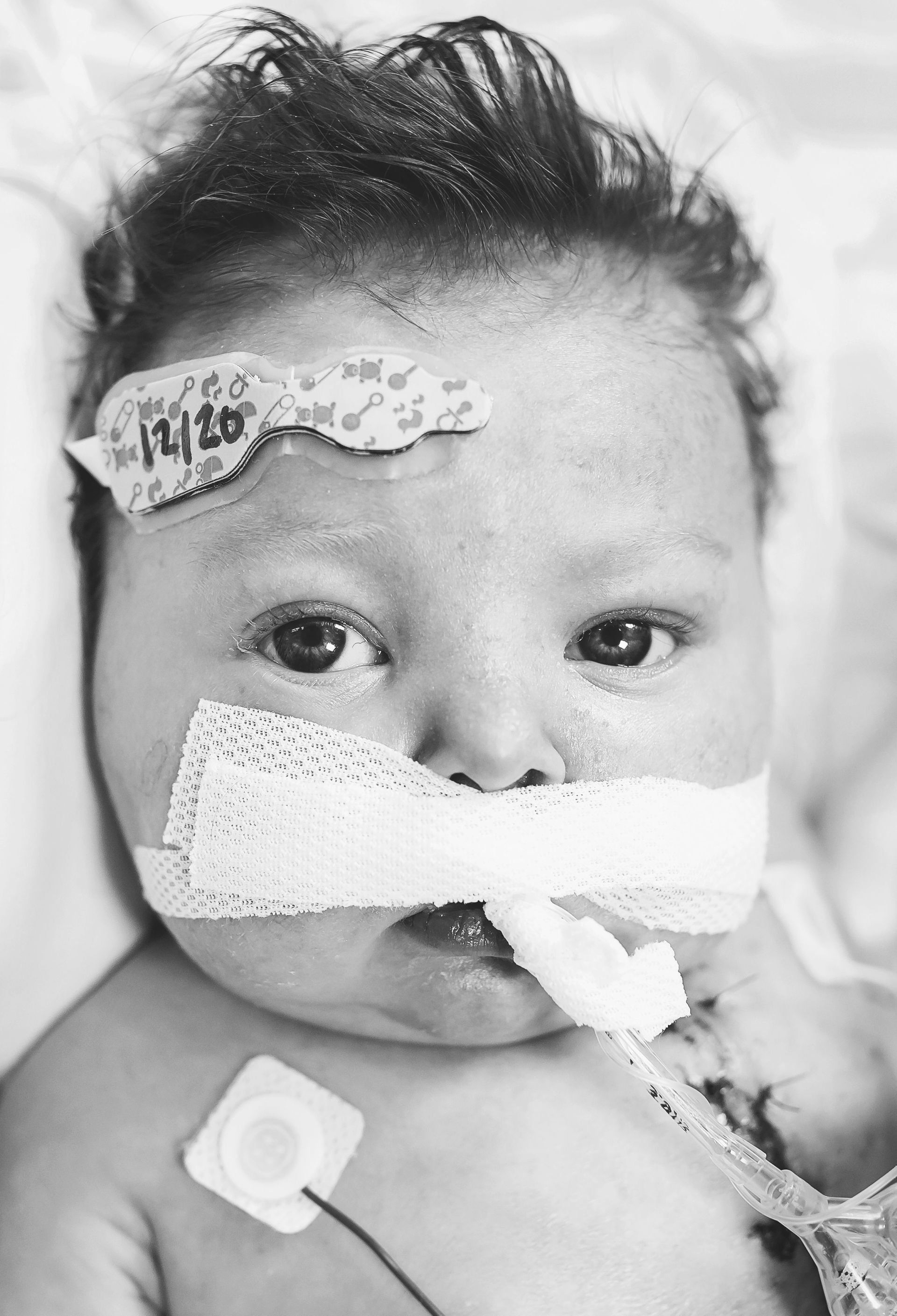 sick baby in the hospital world of broken hearts