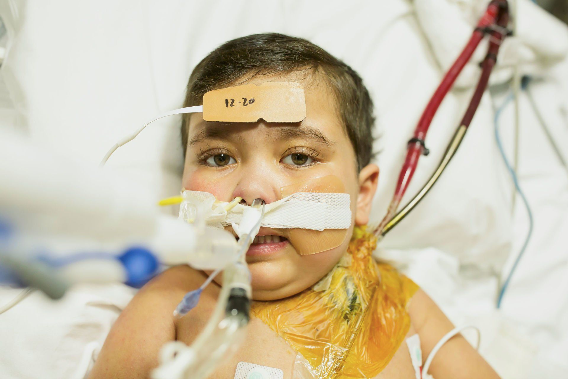 congenital heart defect world of broken hearts