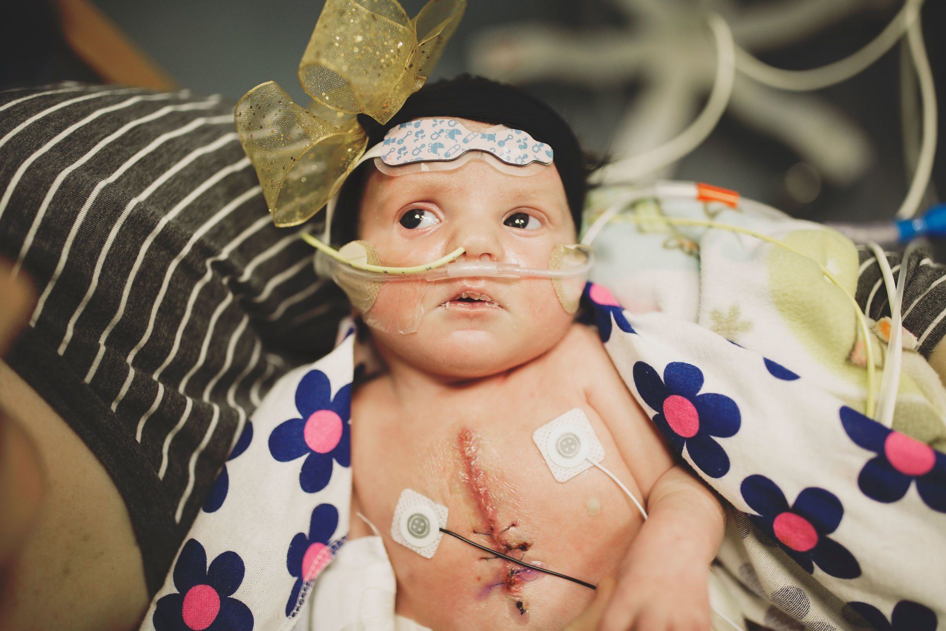 newborn getting heart surgery world of broken hearts