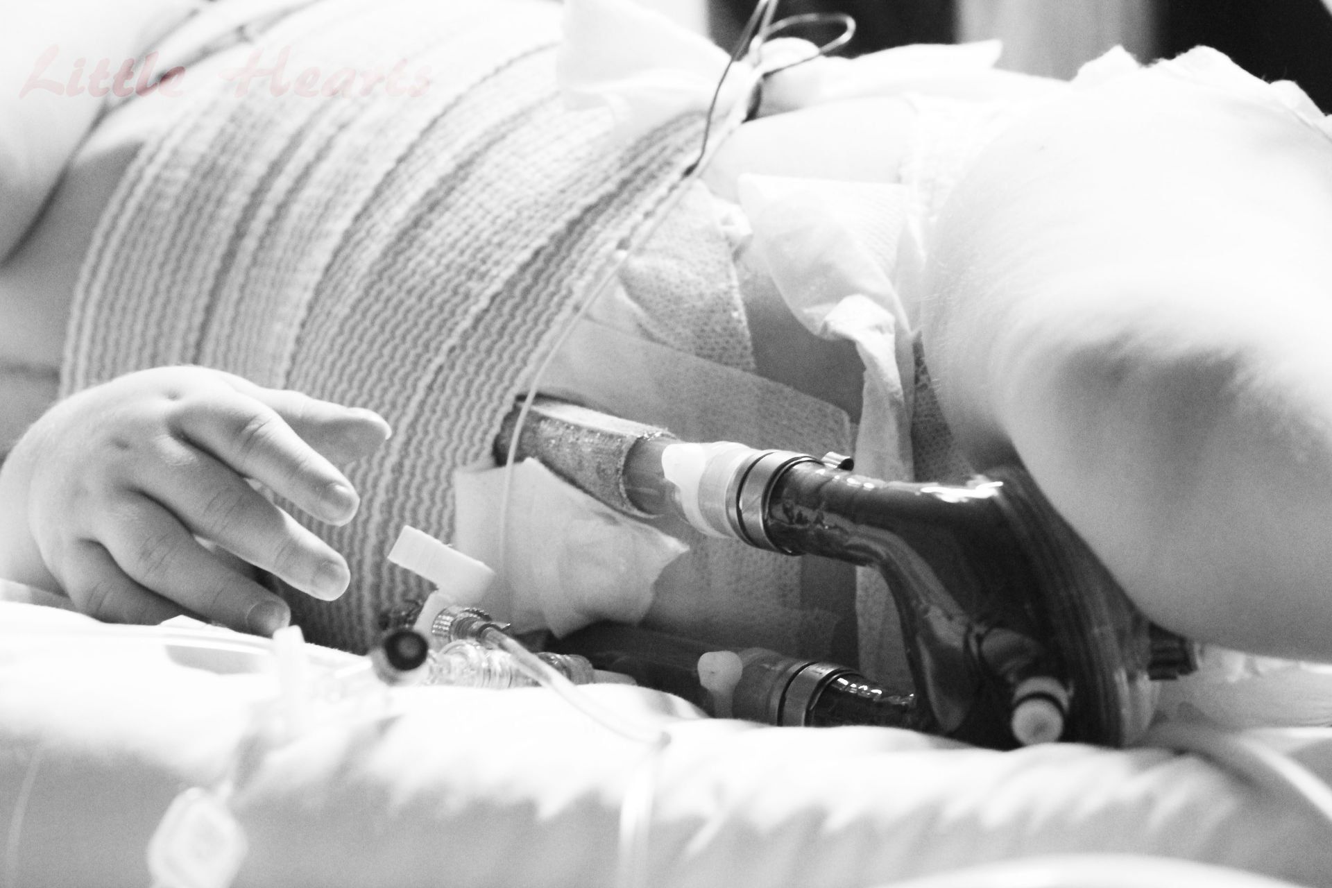 chd baby in the hospital world of broken hearts