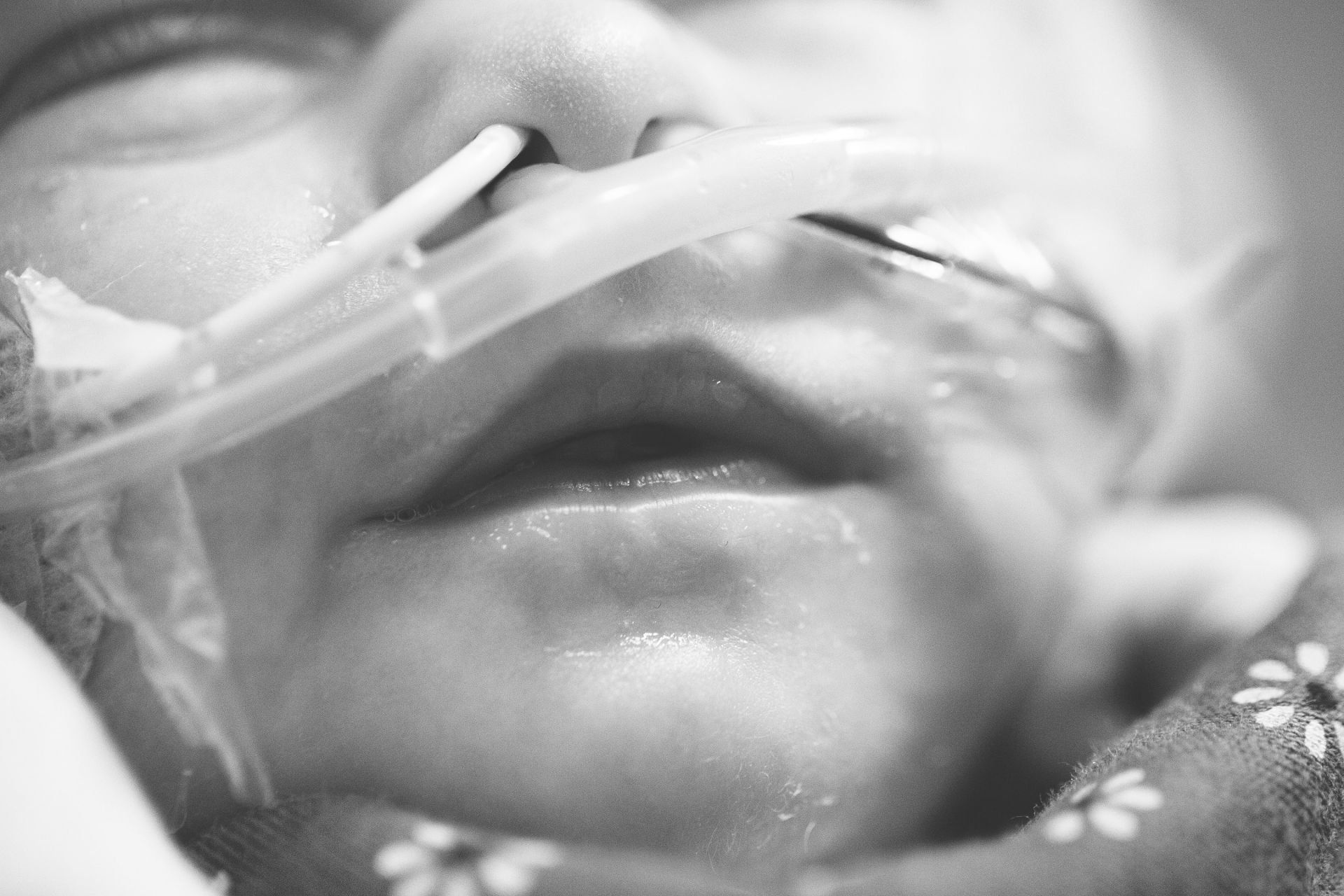 congenital heart disease
