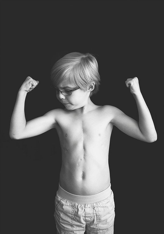 world of broken hearts strong chd child