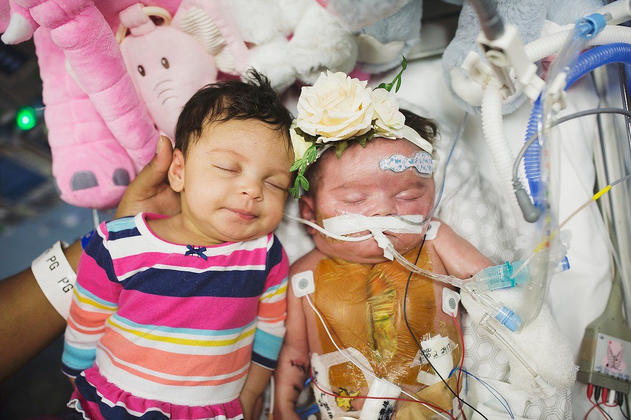 world of broken hearts chd babies