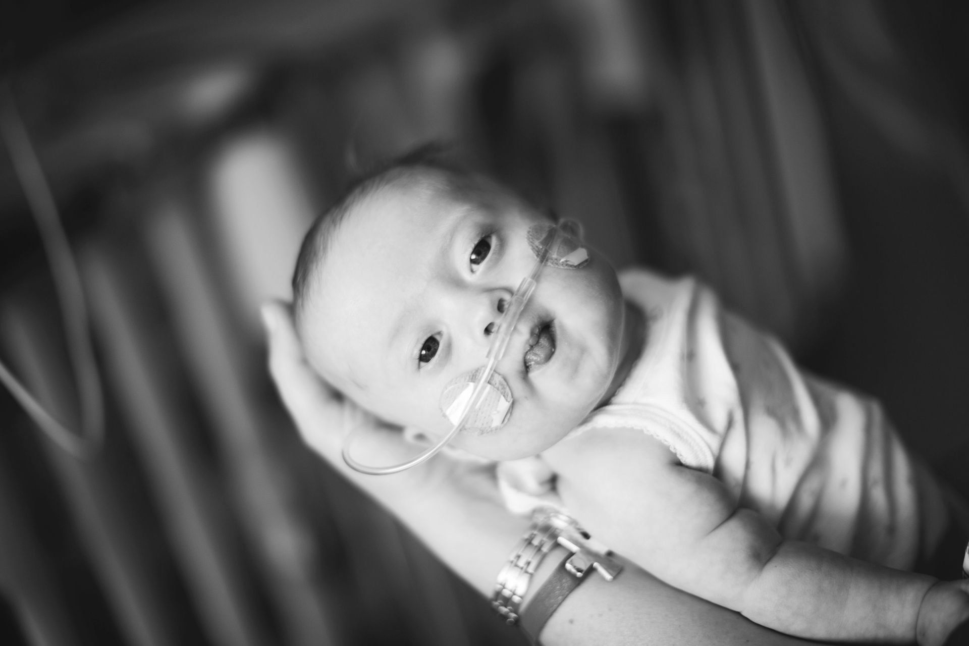 newborn with congenital heart defect world of broken hearts