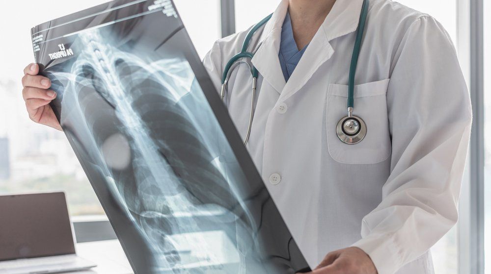 Internal Medicine — Doctor With Radiological Chest X-ray In Big Spring, TX Internal Medicine — Doctor With Radiological Chest X-ray In Big Spring, TX