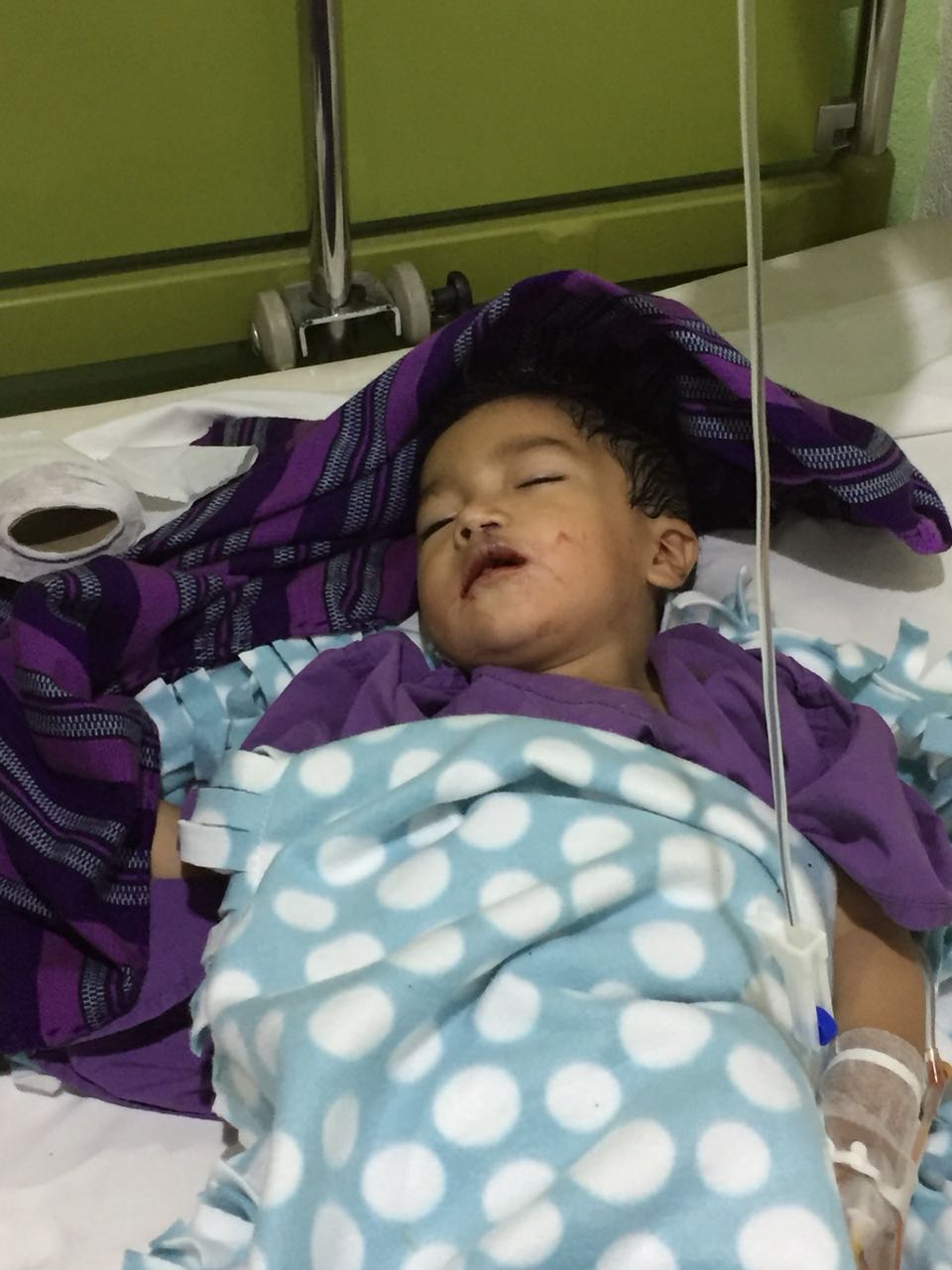 Ein Kind liegt mit einem Infusionsschlauch im Krankenhausbett, in Decken gehüllt, und scheint zu schlafen.