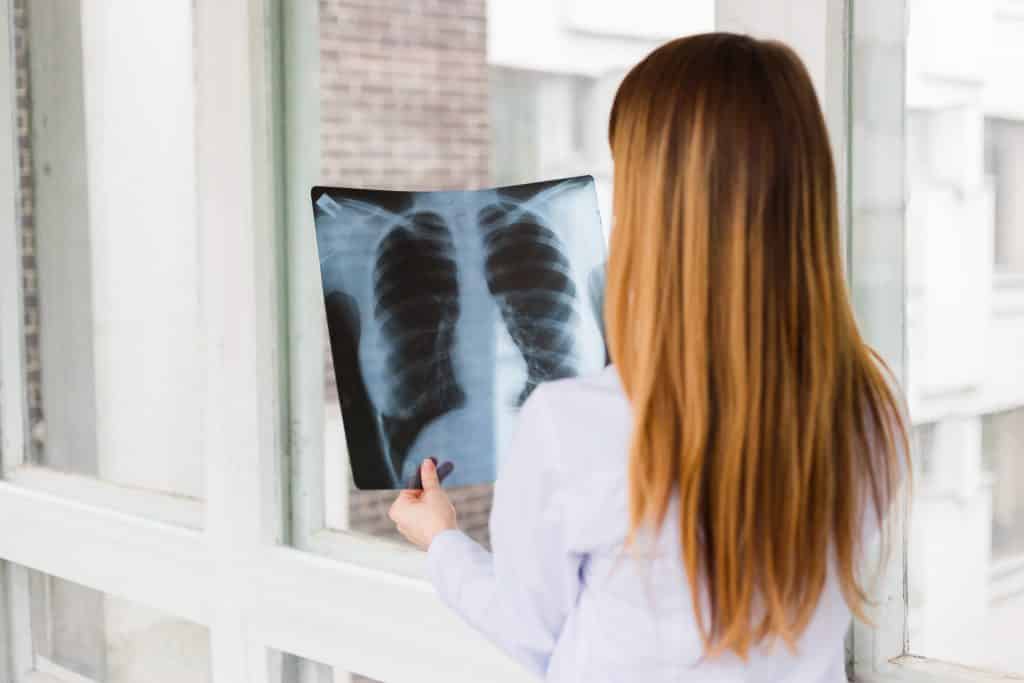 Uma médica está examinando uma radiografia dos pulmões de um paciente.
