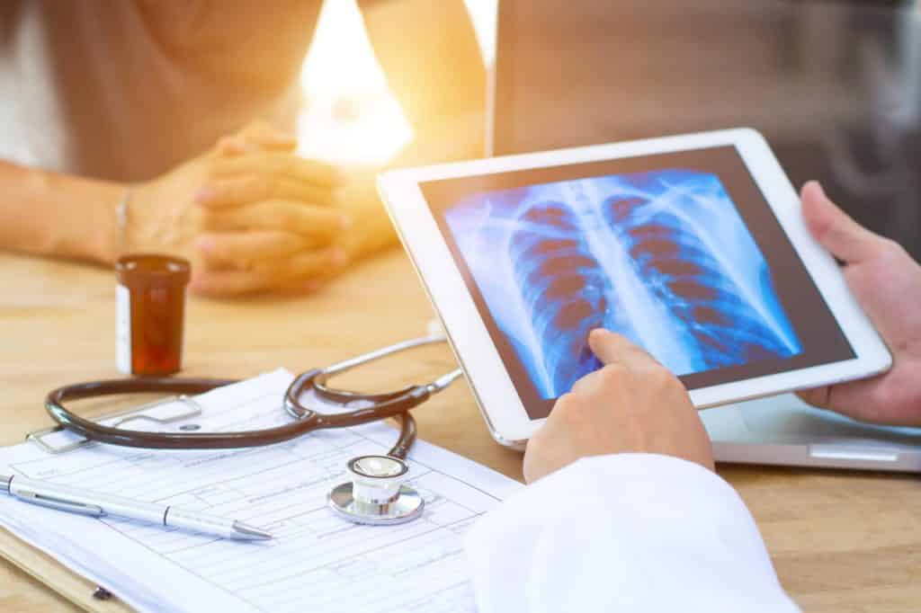 Um médico está analisando uma radiografia dos pulmões de um paciente em um tablet.
