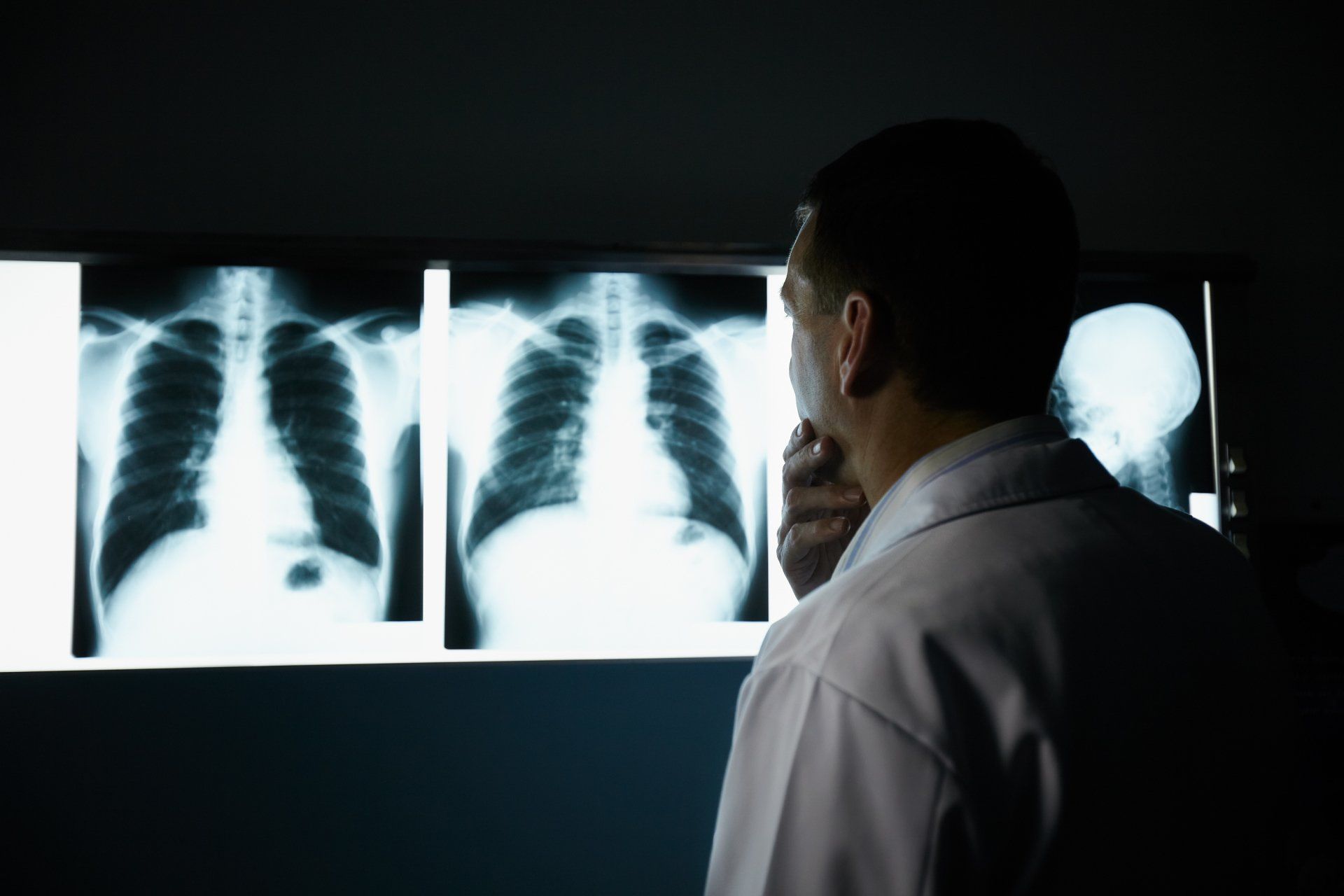Fibrose Pulmonar