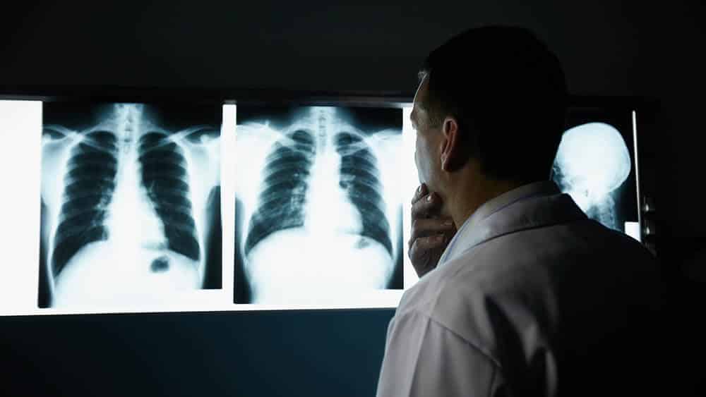 Um médico está examinando uma radiografia do tórax de uma pessoa.