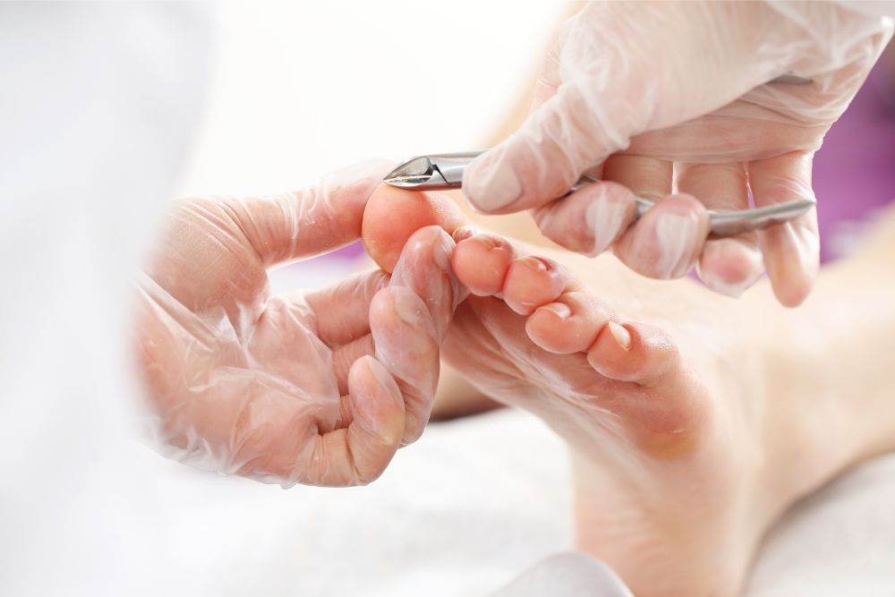 trattamento per piede geriatrico