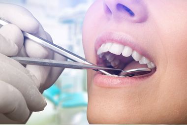 inspection of upper jaw teeth