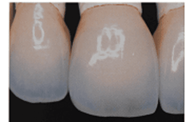 dental care in Rome