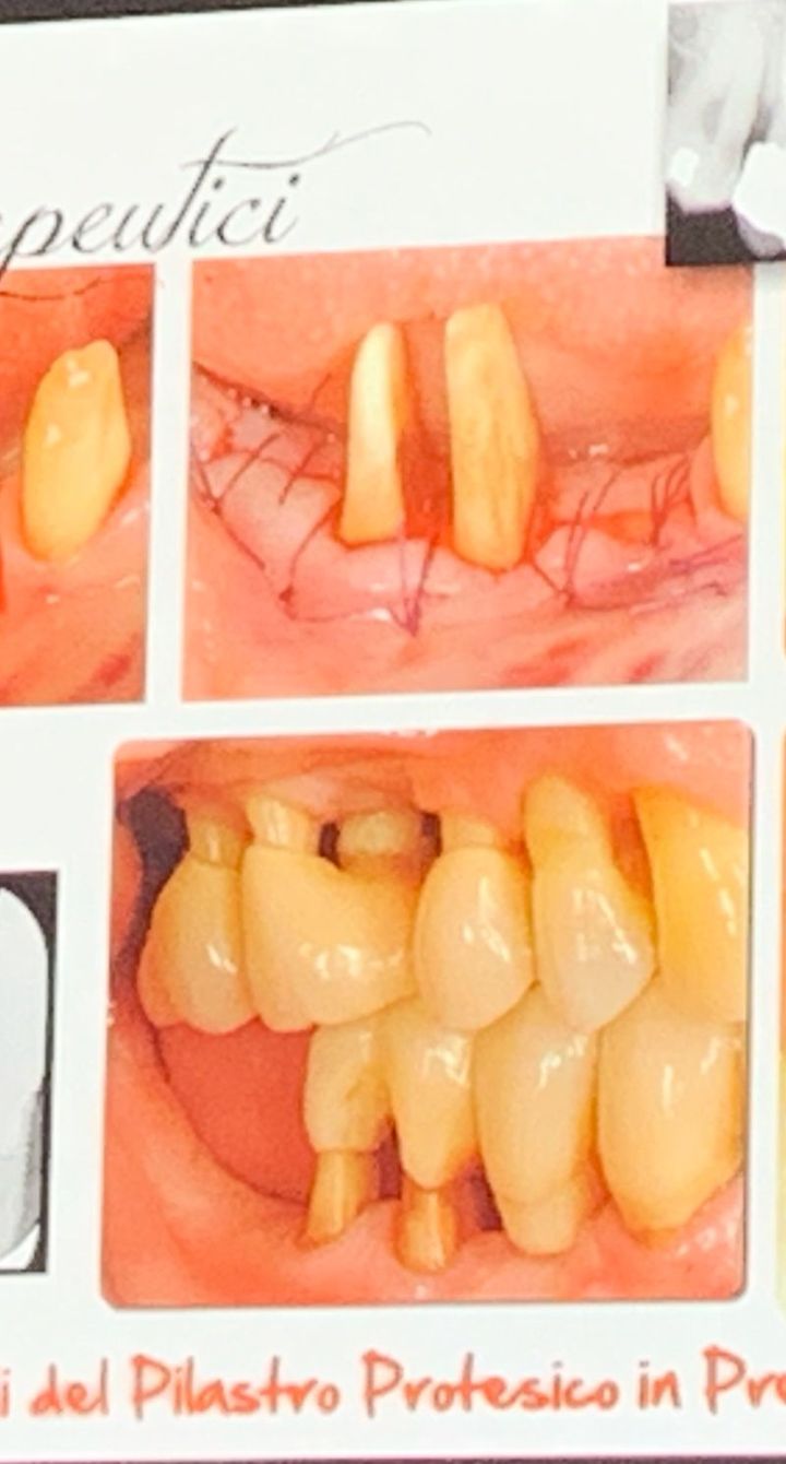 chirurgia dentale
