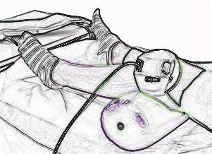 bemer terapia fisica vascolare