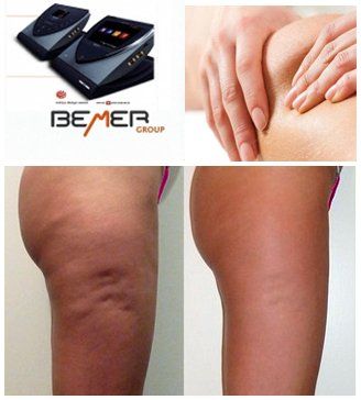 MASSAGGIO ANTICELLULITE + BEMER