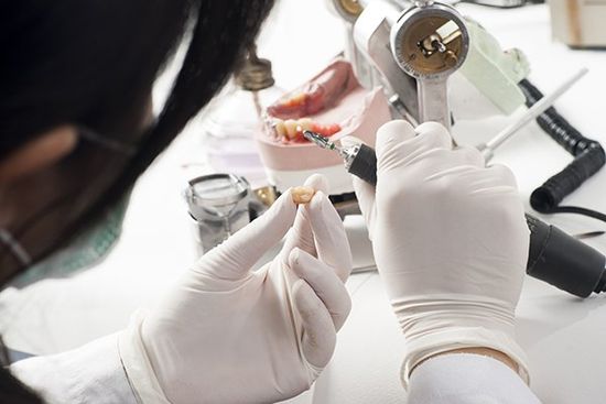 un dentista che lavora su una protesi dentale