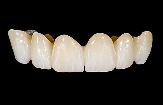 dispositivo dentale in ceramica