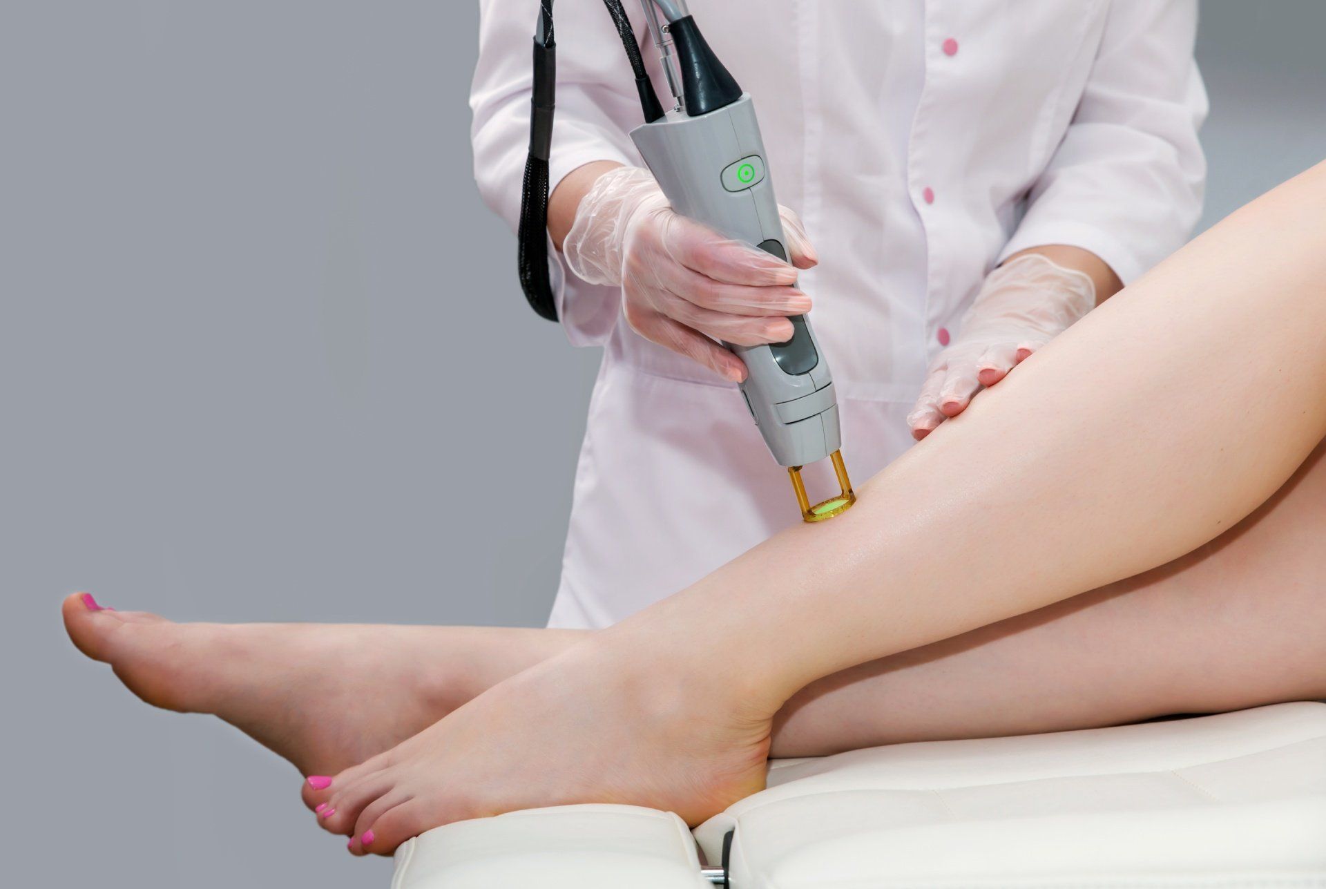 trattamento laser alle gambe
