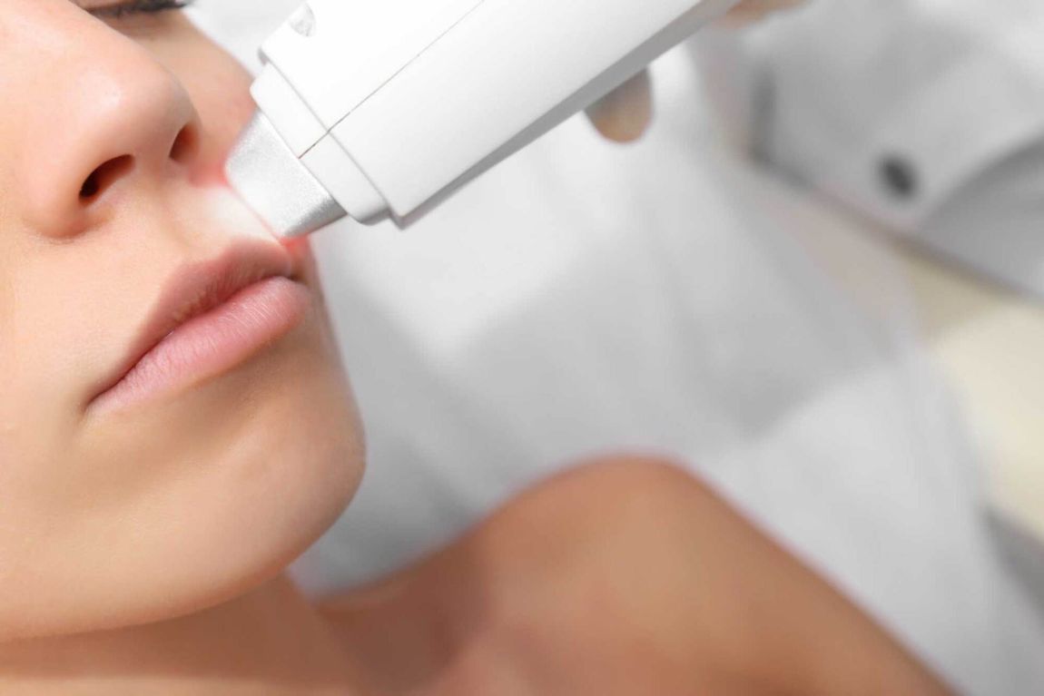 trattamento con laser