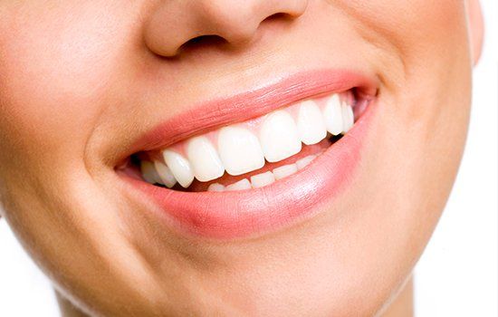 Lady's White Teeth — Colorado Springs, CO — Smile Heart Dental Hygiene Lady's White Teeth — Colorado Springs, CO — Smile Heart Dental Hygiene