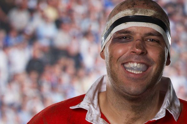 rugby player wearing mouthguard and smiling