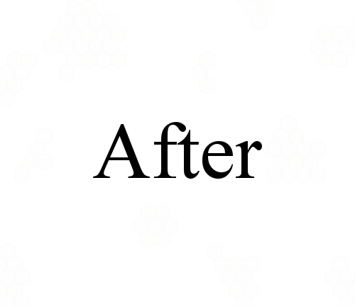 The word “After” in black text on a white background