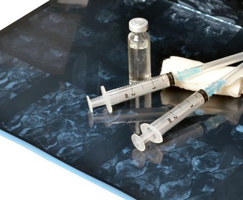 Bone Grafting