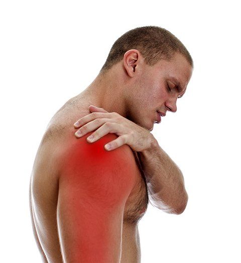Complex Regional Pain Syndrome