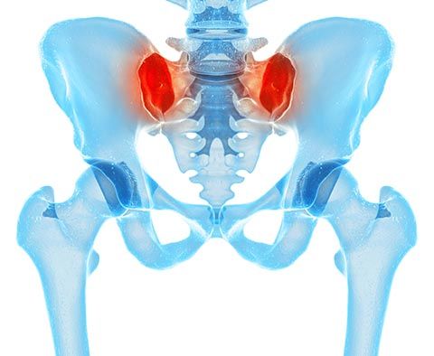 Sacroiliac Joint Dysfunction Sacroiliac Joint Dysfunction