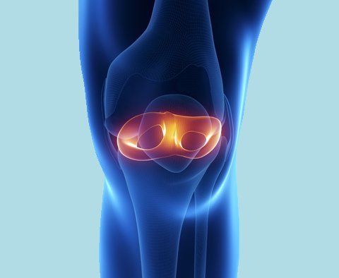 Torn Meniscus Torn Meniscus