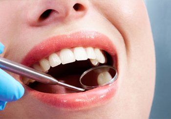 Tooth filling and bonding