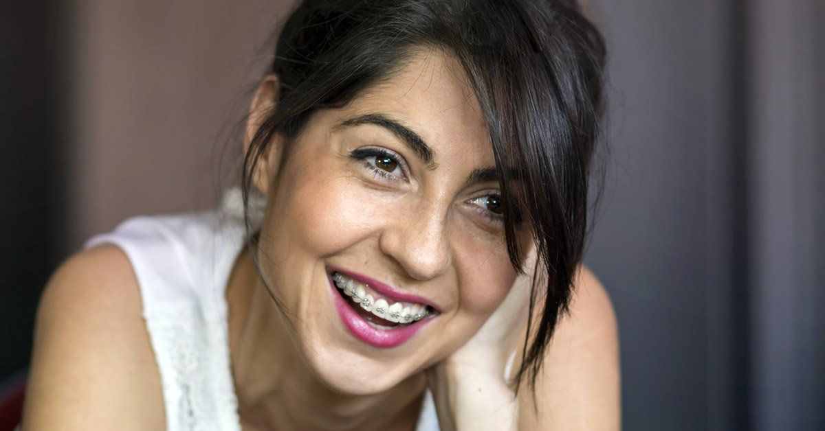 dental veneers, how do veneers work, best dentist for veneers, dental veneers near me