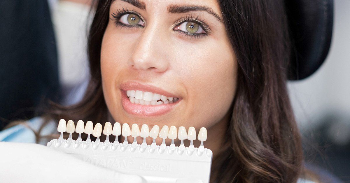 dental veneers, how do veneers work, best dentist for veneers, dental veneers near me