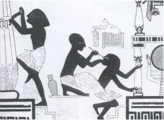 The history of cataract surgery vision quest medical center 