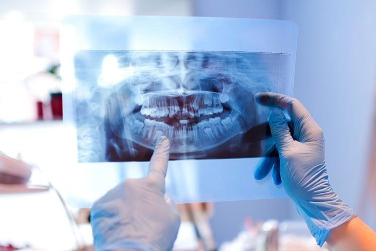 teeth xray