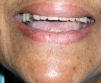 Dental 2