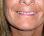 Dental 4