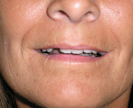 Dental 3