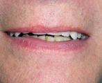 Dental 5