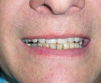 Dental 6