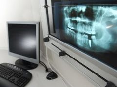 radiologia dentale radiologia dentale