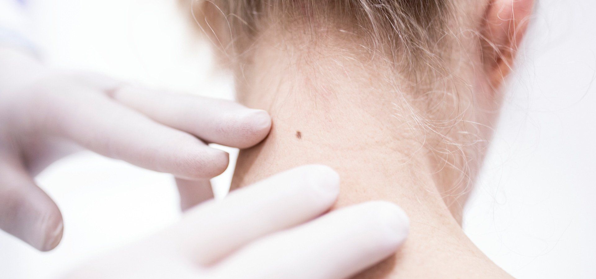Doctor checking skin of a patient
