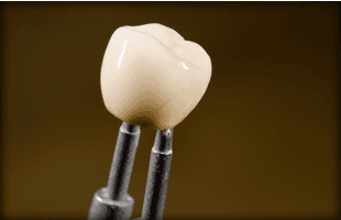 If you need your dentures replacing or repairing in North London call 020 8807 2130 Close up of dental prosthetic