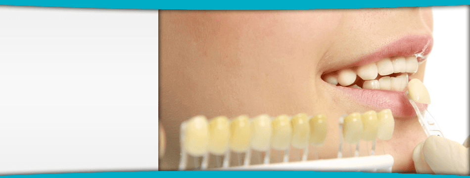 For same day denture repairs in North London call 020 8807 2130 teeth colour chart examination