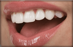 Open mouth of smiling woman with white teeth