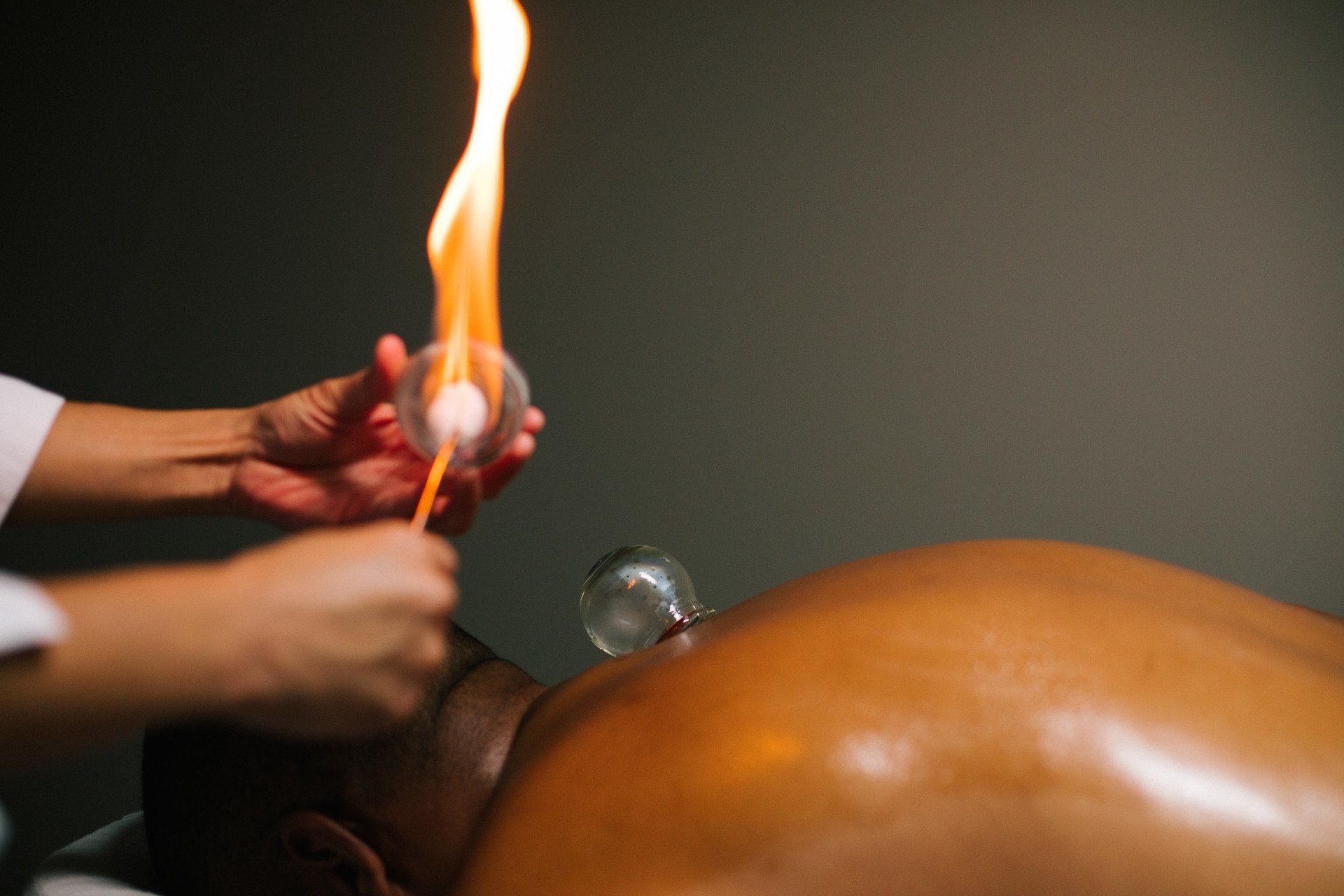 fire cupping in kansas city