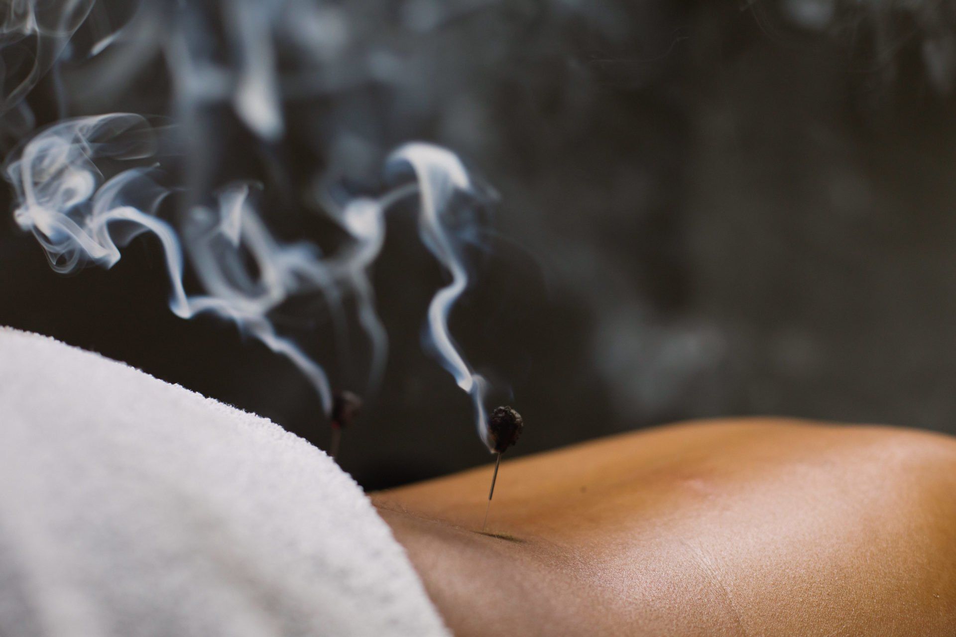 moxibustion in kansas city